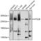 Autophagy Related 2B antibody, GTX66527, GeneTex, Western Blot image 