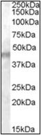 Potassium Voltage-Gated Channel Subfamily J Member 11 antibody, AP22546PU-N, Origene, Western Blot image 