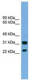 CD8b Molecule antibody, TA329512, Origene, Western Blot image 