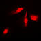Mitogen-Activated Protein Kinase Kinase 4 antibody, LS-C368411, Lifespan Biosciences, Immunofluorescence image 