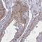 CPI17 antibody, NBP2-37897, Novus Biologicals, Immunohistochemistry frozen image 