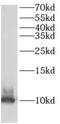 AKAP-7 isoform gamma antibody, FNab00257, FineTest, Western Blot image 