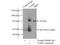 TNF Receptor Superfamily Member 1B antibody, 19272-1-AP, Proteintech Group, Immunoprecipitation image 