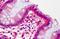 Lipoma-preferred partner antibody, orb88962, Biorbyt, Immunohistochemistry paraffin image 