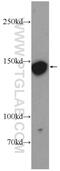 Prune Homolog 2 With BCH Domain antibody, 11458-1-AP, Proteintech Group, Western Blot image 
