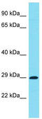 Chromosome 7 Open Reading Frame 57 antibody, TA332204, Origene, Western Blot image 