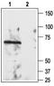 Reticulon 4 Receptor antibody, TA328650, Origene, Western Blot image 
