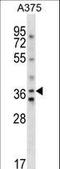 Arginine Vasopressin Receptor 1A antibody, LS-C156694, Lifespan Biosciences, Western Blot image 