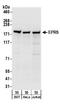 Glutamyl-Prolyl-TRNA Synthetase antibody, A303-958A, Bethyl Labs, Western Blot image 