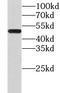 Charged Multivesicular Body Protein 7 antibody, FNab01662, FineTest, Western Blot image 