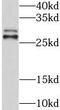 Glutathione S-transferase theta-1 antibody, FNab03700, FineTest, Western Blot image 