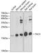 Tachykinin 3 antibody, 22-121, ProSci, Western Blot image 