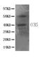 C-C Motif Chemokine Receptor 5 (Gene/Pseudogene) antibody, PA1016, Boster Biological Technology, Immunohistochemistry paraffin image 