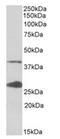 Uroporphyrinogen decarboxylase antibody, AP32135PU-N, Origene, Western Blot image 