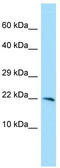 Chromosome X Open Reading Frame 40A antibody, TA331320, Origene, Western Blot image 