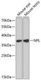 N-Acetylneuraminate Pyruvate Lyase antibody, GTX66561, GeneTex, Western Blot image 