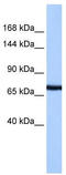 Protocadherin-15 antibody, TA339641, Origene, Western Blot image 