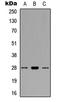 BCL2 antibody, LS-C358426, Lifespan Biosciences, Western Blot image 