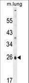 Solute Carrier Family 66 Member 2 antibody, LS-C162104, Lifespan Biosciences, Western Blot image 