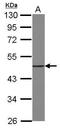 Eukaryotic initiation factor 4A-I antibody, GTX107319, GeneTex, Western Blot image 