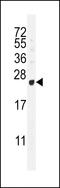 G Antigen 12E antibody, 55-739, ProSci, Western Blot image 