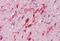 Hepatocyte Growth Factor antibody, MBS245408, MyBioSource, Immunohistochemistry paraffin image 
