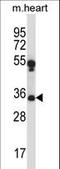  antibody, LS-C164032, Lifespan Biosciences, Western Blot image 