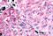 Prostaglandin E Receptor 1 antibody, MBS243478, MyBioSource, Immunohistochemistry paraffin image 