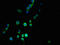 Mannosidase Beta Like antibody, orb355559, Biorbyt, Immunofluorescence image 