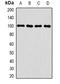 Chloride Voltage-Gated Channel 5 antibody, orb377998, Biorbyt, Western Blot image 