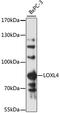 Lysyl oxidase homolog 4 antibody, LS-C748192, Lifespan Biosciences, Western Blot image 