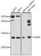 Serum Amyloid A4, Constitutive antibody, A07115-1, Boster Biological Technology, Western Blot image 
