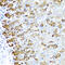 Matrix Gla protein antibody, 19-662, ProSci, Immunohistochemistry paraffin image 