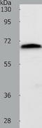 Solute Carrier Family 22 Member 3 antibody, TA322213, Origene, Western Blot image 