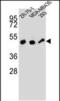 ZFP30 Zinc Finger Protein antibody, PA5-48578, Invitrogen Antibodies, Western Blot image 