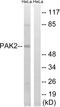 P21 (RAC1) Activated Kinase 2 antibody, LS-C199402, Lifespan Biosciences, Western Blot image 