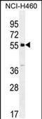 Shisa Family Member 6 antibody, PA5-48308, Invitrogen Antibodies, Western Blot image 