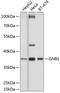 G Protein Subunit Beta 1 antibody, 18-356, ProSci, Western Blot image 