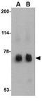RNA-binding protein MEX3C antibody, GTX85374, GeneTex, Western Blot image 