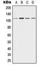 Desmoglein-3 antibody, orb213861, Biorbyt, Western Blot image 