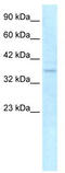 NLR Family CARD Domain Containing 4 antibody, TA330316, Origene, Western Blot image 