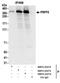 Pre-MRNA Processing Factor 8 antibody, NBP2-22274, Novus Biologicals, Immunoprecipitation image 