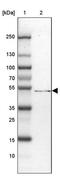 SMG9 Nonsense Mediated MRNA Decay Factor antibody, PA5-59866, Invitrogen Antibodies, Western Blot image 