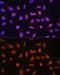 General Transcription Factor IIH Subunit 1 antibody, GTX66483, GeneTex, Immunofluorescence image 