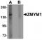 Zinc Finger MYM-Type Containing 1 antibody, TA320019, Origene, Western Blot image 