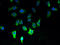 Mitochondrial Calcium Uniporter Dominant Negative Beta Subunit antibody, A58458-100, Epigentek, Immunofluorescence image 