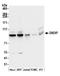 UTP25 Small Subunit Processor Component antibody, A305-122A, Bethyl Labs, Western Blot image 