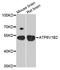 ATPase H+ Transporting V1 Subunit B2 antibody, A04927, Boster Biological Technology, Western Blot image 