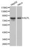 Alkaline Phosphatase, Biomineralization Associated antibody, abx001003, Abbexa, Western Blot image 