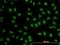 BCL9 Transcription Coactivator antibody, H00000607-M01, Novus Biologicals, Immunocytochemistry image 